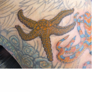 Hilly Starfish