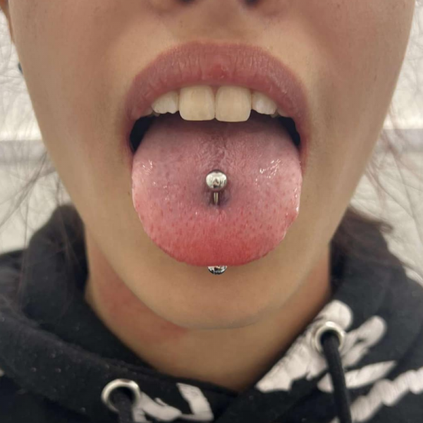 Tongue