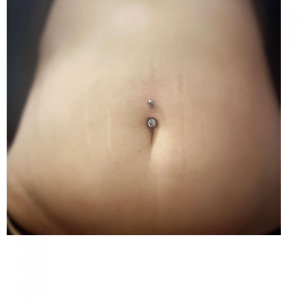 Navel