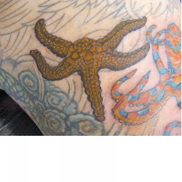 Starfish