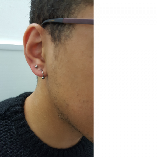 2nd Lobe