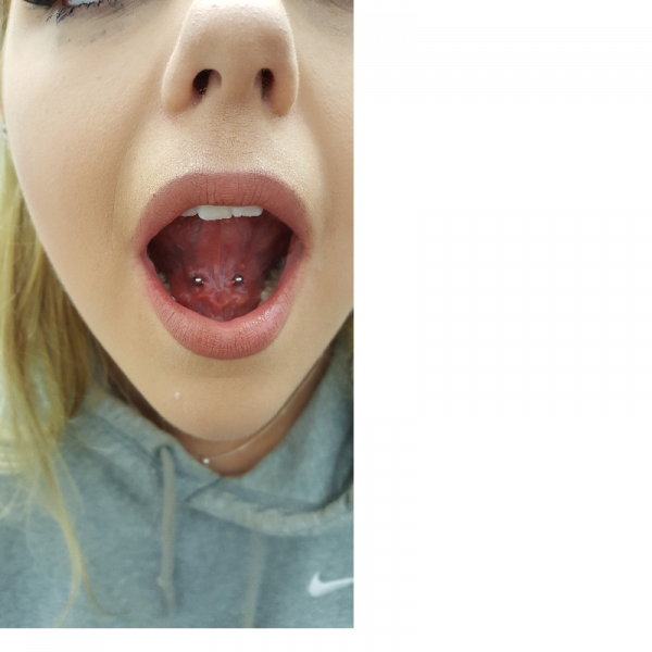 Tongue Web
