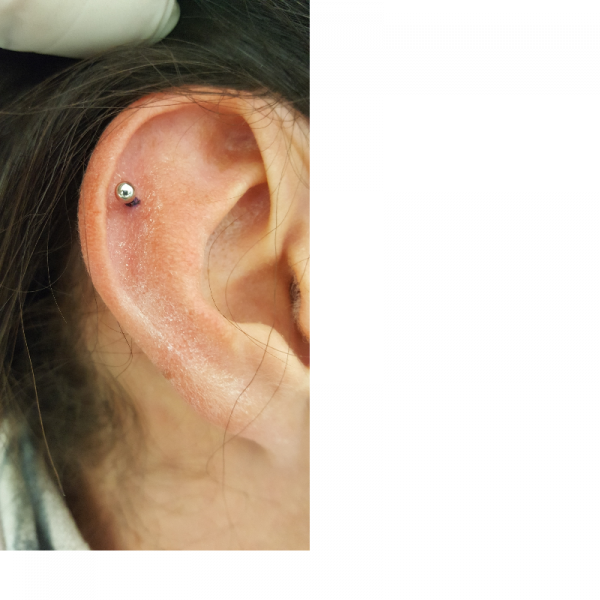 Auricle